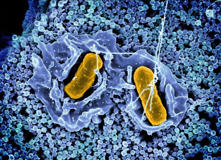 Why are there so many Salmonella outbreaks? 4 reasons for the nonstop food recalls, sicknesses, and safety warnings this year