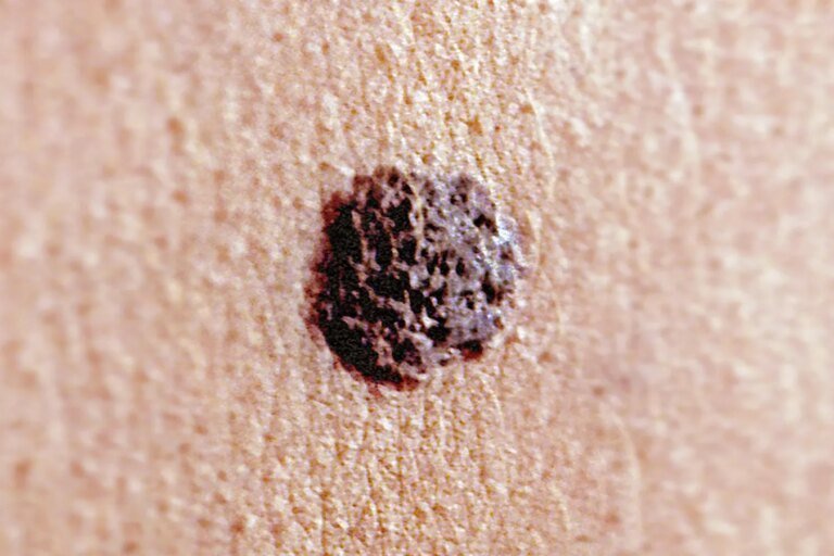New Study Shows How mRNA Vaccines Could Transform Cancer Treatment