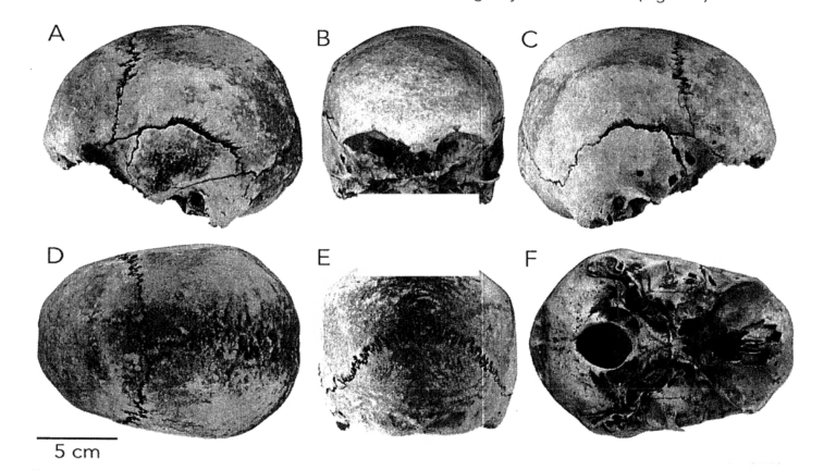 Kayakers Discover Human Skull in Cuyahoga Valley National Park